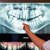 How are dental check-ups going?